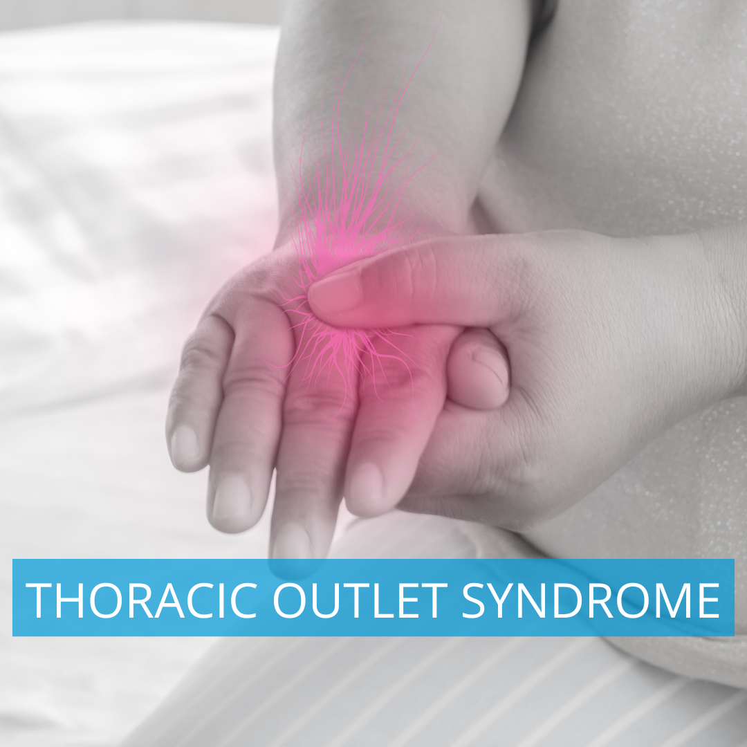 Thoracic outlet syndrom